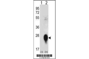 Western blot analysis of CLEC3B using rabbit polyclonal CLEC3B Antibody using 293 cell lysates (2 ug/lane) either nontransfected (Lane 1) or transiently transfected (Lane 2) with the CLEC3B gene. (CLEC3B anticorps  (AA 95-122))