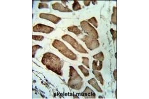 Formalin-fixed and paraffin-embedded human skeletal muscle reacted with LMOD1 Antibody (Center ), which was peroxidase-conjugated to the secondary antibody, followed by DAB staining.