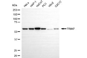 Western blotting analysis using TRIM7 antibody (ABIN7800643).