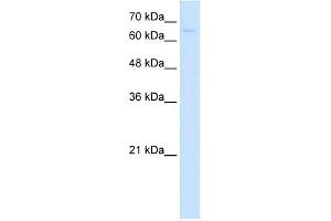 WB Suggested Anti-CTPS Antibody Titration:  5. (CTP Synthase anticorps  (C-Term))
