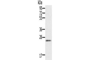 Gel: 10 % SDS-PAGE, Lysate: 40 μg, Lane: Human heart tissue, Primary antibody: ABIN7192155(RBM38 Antibody) at dilution 1/200, Secondary antibody: Goat anti rabbit IgG at 1/8000 dilution, Exposure time: 1 minute