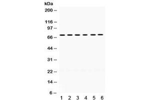 Western blot testing of mouse 1) brain, 2) liver, 3) thymus, 4) testis, 5) human 293 and 6) HeLa lysate with LIMK2 antibody. (LIMK2 anticorps)