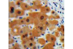 Used in DAB staining on fromalin fixed paraffin-embedded Liver tissue