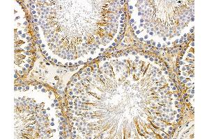 ABIN7095914 and ABIN7099976 at 1/100 staining rat testis tissue by IHC-P. (CCSER1 anticorps)