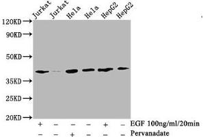 Western Blot  Positive WB detected in:Jurkat whole cell lysate, Hela whole cell lysate, HepG2 whole cell lysate(treated with EGF or Pervanadate)  All lanes: Phospho-LAT antibody at 2.