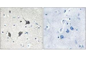 Immunohistochemistry analysis of paraffin-embedded human brain tissue, using GPR20 Antibody. (GPR20 anticorps  (AA 291-340))
