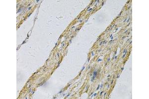 Immunohistochemistry of paraffin-embedded Human smooth muscle using PRNP Polyclonal Antibody at dilution of 1:100 (40x lens). (PRNP anticorps)