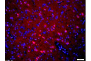 Formalin-fixed and paraffin embedded rat brain labeled with Rabbit Anti-5HT2A Receptor/SR-2A Polyclonal Antibody, Unconjugated at 1:200 followed by conjugation to the secondary antibody, Goat Anti-Rabbit IgG, Cy3 conjugated used at 1:200 dilution for 40 minutes at 37 °C. (HTR2A anticorps  (AA 51-150))
