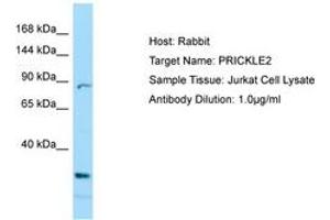 Image no. 1 for anti-Prickle Homolog 2 (PRICKLE2) (C-Term) antibody (ABIN6749993) (PRICKLE2 anticorps  (C-Term))