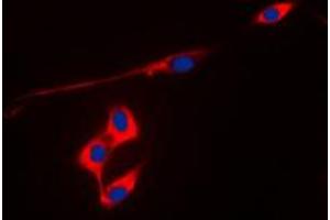 Immunofluorescent analysis of Peroxiredoxin 3 staining in MCF7 cells. (Peroxiredoxin 3 anticorps  (Center))