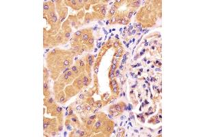 Antibody staining PCCA in human kidney tissue sections by Immunohistochemistry (IHC-P - paraformaldehyde-fixed, paraffin-embedded sections). (PCCA anticorps  (AA 362-390))