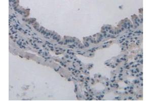 IHC-P analysis of Mouse Lung Tissue, with DAB staining. (Leptin Receptor anticorps  (AA 22-203))