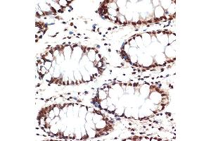 Immunohistochemistry of paraffin-embedded human colon using CDC16 Rabbit mAb (ABIN1678585, ABIN3017837, ABIN3017838 and ABIN7101525) at dilution of 1:100 (40x lens). (CDC16 anticorps)