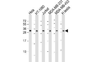 All lanes : Anti-SSX2 Antibody (Center) at 1:2000 dilution Lane 1: Hela whole cell lysates Lane 2: HT-1080 whole cell lysates Lane 3: Jurkat whole cell lysates Lane 4: MDA-MB-231 whole cell lysates Lane 5: MDA-MB-453 whole cell lysates Lane 6: human testis lysates Lysates/proteins at 20 μg per lane.