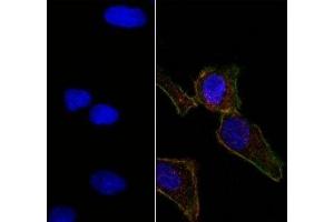 Right: Confocal Immunofluorescent analysis of SK-OV-3 cells using AF488-labeled EpCAM antibody (EGP40/826) (Green).