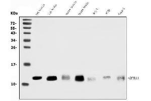 Western blot analysis of DYNLL1/PIN using anti-DYNLL1/PIN antibody (ABIN7599571).