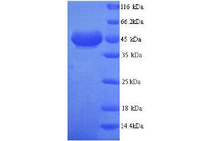 SDS-PAGE (SDS) image for Alcohol Dehydrogenase 7 (Class IV), mu Or sigma Polypeptide (ADH7) (AA 1-386), (full length) protein (His tag) (ABIN5713196) (ADH7 Protein (AA 1-386, full length) (His tag))