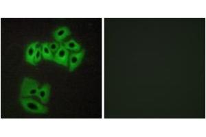 Immunofluorescence analysis of A549 cells, using VAMP4 (Ab-30) Antibody. (VAMP4 anticorps  (AA 1-50))