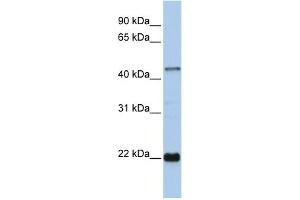 WB Suggested Anti-ZNF581 Antibody Titration:  0. (ZNF581 anticorps  (Middle Region))