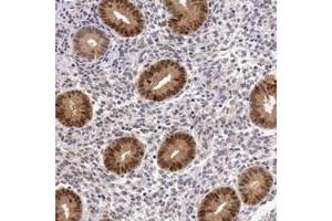 Immunohistochemical staining of human corpus, uterine with FAM122B polyclonal antibody  shows nuclear and cytoplasmic positivity in glandular cells at 1:200-1:500 dilution. (FAM122B anticorps  (AA 11-132))