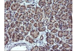 Image no. 2 for anti-Melan A (MLANA) antibody (ABIN1499423) (MLANA anticorps)