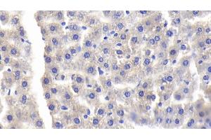 Detection of LBP in Rat Liver Tissue using Polyclonal Antibody to Lipopolysaccharide Binding Protein (LBP)