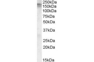 Image no. 1 for anti-Calcium Channel, Voltage-Dependent, L Type, alpha 1C Subunit (CACNA1C) (C-Term) antibody (ABIN375180) (CACNA1C anticorps  (C-Term))