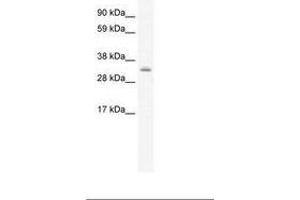 Image no. 1 for anti-PDZ and LIM Domain 1 (PDLIM1) (AA 165-214) antibody (ABIN202250) (PDLIM1 anticorps  (AA 165-214))