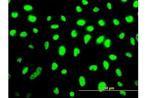 Immunofluorescence of monoclonal antibody to SMU1 on HeLa cell. (SMU1 anticorps  (AA 1-513))