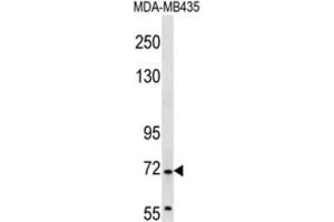 Western Blotting (WB) image for anti-Grainyhead-Like 2 (GRHL2) antibody (ABIN2997171) (GRHL2 anticorps)
