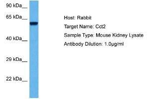 Host: Mouse Target Name: CCT2 Sample Tissue: Mouse Kidney Antibody Dilution: 1ug/ml (CCT2 anticorps  (Middle Region))