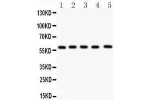 Western Blotting (WB) image for anti-Nuclear Receptor Subfamily 5, Group A, Member 2 (NR5A2) (AA 44-237) antibody (ABIN3043579) (NR5A2 + LRH1 anticorps  (AA 44-237))