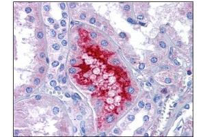 Human Kidney: Formalin-Fixed, Paraffin-Embedded (FFPE) (MATN1 anticorps  (C-Term))