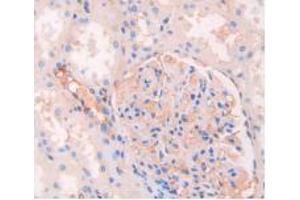 IHC-P analysis of Human Kidney Tissue, with DAB staining. (Lapin anti-Humain IgG4 (AA 222-327) Anticorps)