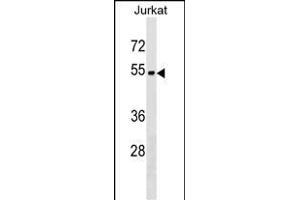 ZN Antibody (Center) (ABIN1538123 and ABIN2849842) western blot analysis in Jurkat cell line lysates (35 μg/lane). (ZNF703 anticorps  (AA 226-254))