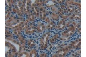 Detection of ACP5 in Rat Kidney Tissue using Polyclonal Antibody to Acid Phosphatase 5, Tartrate Resistant (ACP5)