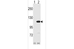Western blot analysis of MVP using rabbit polyclonal MVP C-term Antibody using 293 cell lysates (2 ug/lane) either nontransfected (Lane 1) or transiently transfected with the MVP gene (Lane 2). (MVP anticorps  (C-Term))