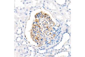 Immunohistochemistry of paraffin-embedded Human kidney using CD35/CR1 antibody (ABIN7266477) at dilution of 50 (40x lens). (CD35 anticorps)