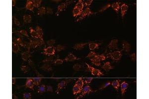 Immunofluorescence analysis of C6 cells using MAOA Polyclonal Antibody at dilution of 1:100. (Monoamine Oxidase A anticorps)