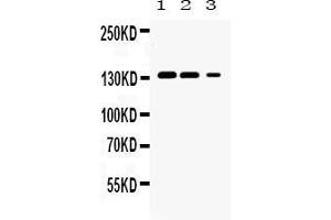 Western blot analysis of JAK1 expression in rat kidney extract ( Lane 1), mouse kidney extract ( Lane 2) and HELA whole cell lysates ( Lane 3). (JAK1 anticorps  (N-Term))