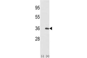 Western blot analysis of IL-1 alpha antibody and 293 cell lysate (2 ug/lane) either nontransfected (Lane 1) or transiently transfected with the IL1A gene (2).