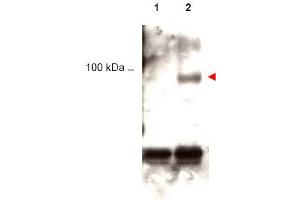 Image no. 1 for anti-Signal Transducer and Activator of Transcription 1, 91kDa (STAT1) (pTyr701) antibody (ABIN401047) (STAT1 anticorps  (pTyr701))
