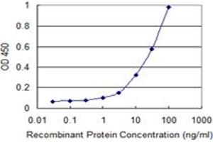 Detection limit for recombinant GST tagged STIM1 is 0. (STIM1 anticorps  (AA 24-685))