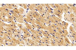 Detection of TLR2 in Porcine Cardiac Muscle Tissue using Polyclonal Antibody to Toll Like Receptor 2 (TLR2) (TLR2 anticorps  (AA 47-245))