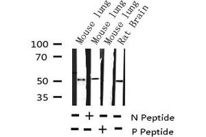 Western blot analysis of Phospho-AML1 (Ser303) expression in various lysates