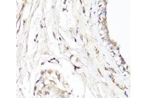Immunohistochemistry of paraffin-embedded Human breast using CDK7 Polyclonal Antibody at dilution of 1:150 (40x lens).