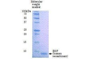 SDS-PAGE (SDS) image for Epidermal Growth Factor (EGF) (Active) protein (ABIN2452188) (EGF Protéine)