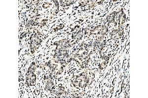 IHC analysis of C-Jun/JUN using anti-C-Jun/JUN antibody (ABIN7601421).