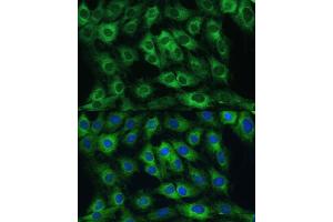 Immunofluorescence analysis of C6 cells using FRMD6 antibody (ABIN6132194, ABIN6140773, ABIN6140774 and ABIN6225347) at dilution of 1:100. (FRMD6 anticorps  (AA 405-614))