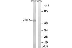 Western blot analysis of extracts from LOVO cells, using SLC30A1 Antibody. (SLC30A1 anticorps  (AA 201-250))